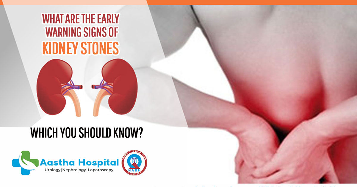 What are the early warning signs of kidney stones which you should know