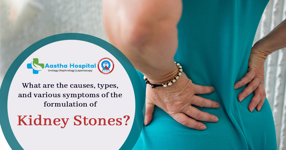 Formulation Of Kidney Stones: Causes, Types, Symptoms