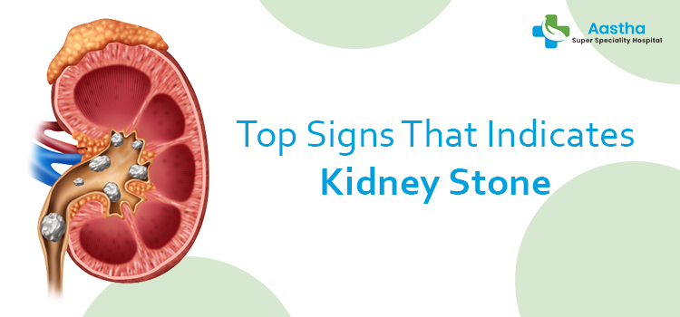 Top Signs That Indicates Kidney Stone