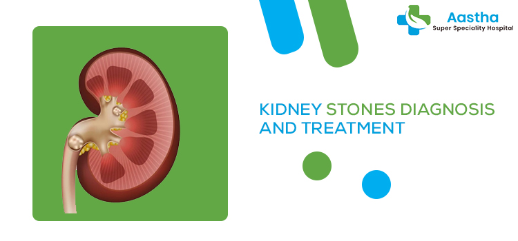 Diagnosis And Treatment For Small And Large Kidney Stones