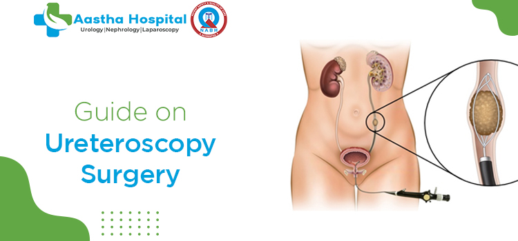Everything you need to know about Ureteroscopy surgery