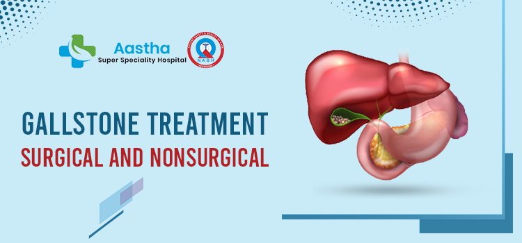 Gallstone Treatment: Surgical And Nonsurgical