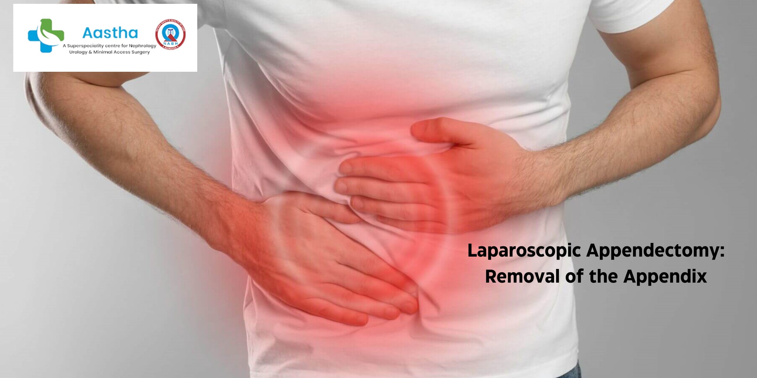 Laparoscopic Appendectomy- Removal of Appendix